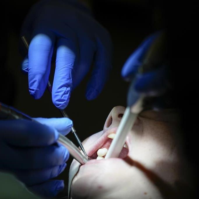 Dentists decry being left in the dark about federal dental insurance plan